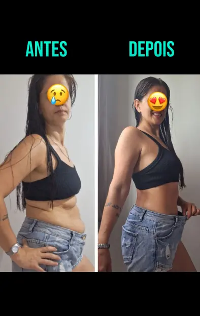 Antes e Depois de usar Secaps Black